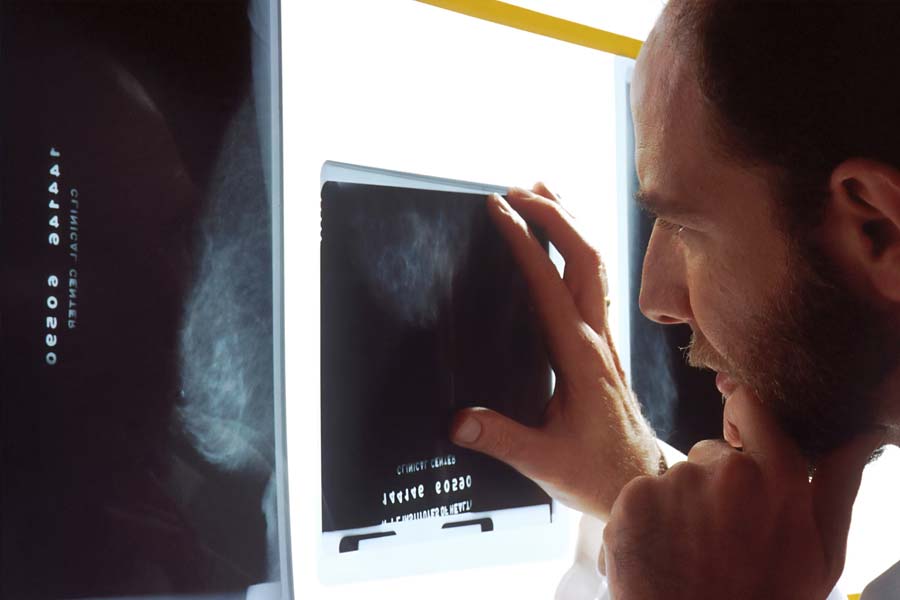 ফুসফুসের অ্যালভিওলা বা রন্ধ্রজনিত কোনও রোগের কারণে ‘হোয়াইট লাং সিনড্রোম’ হতে পারে। আবার সিলিকোসিস রোগে আক্রান্ত হলেও ফুসফুসে এই রোগে দানা বাঁধতে পারে। 