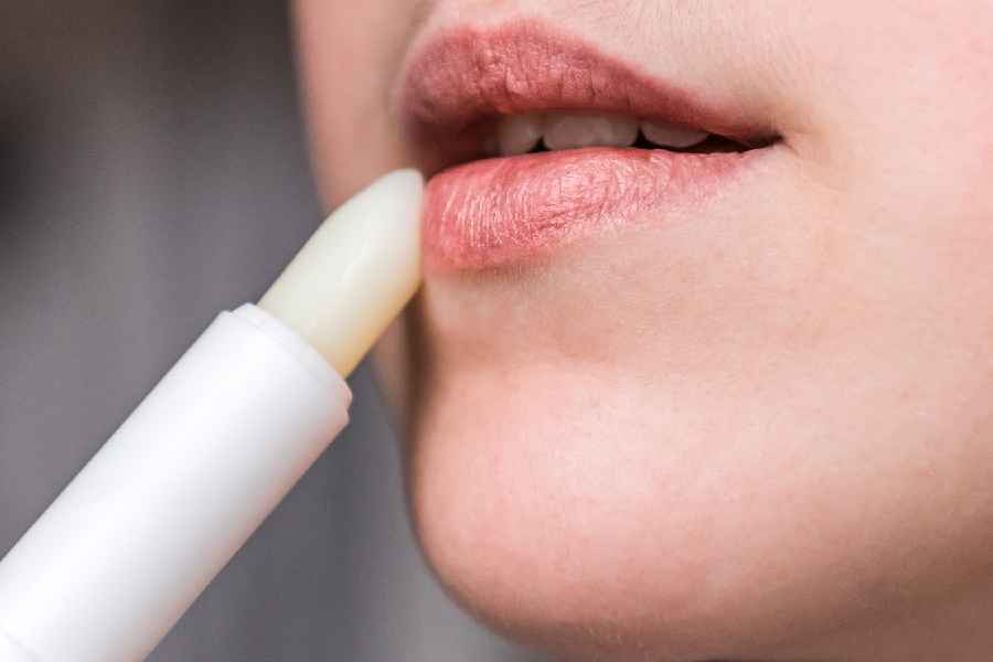 Five beauty hacks to cure chapped lips in this winter season.