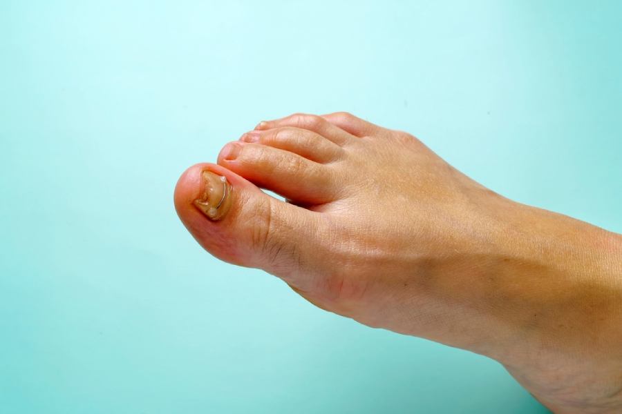 image of nails