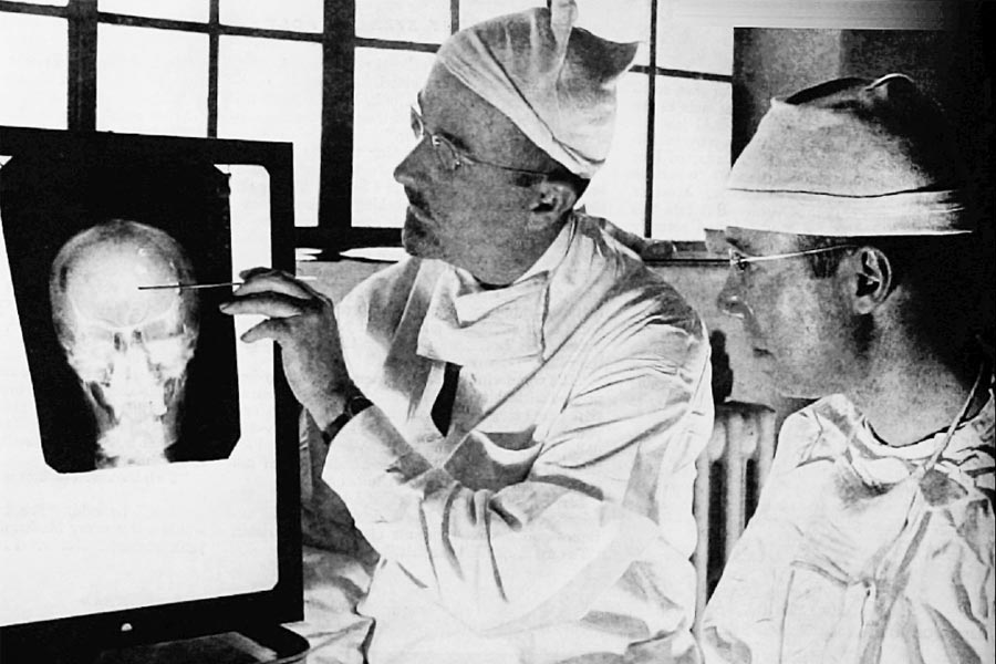 Lobotomy surgery was performed to treat mental illness.