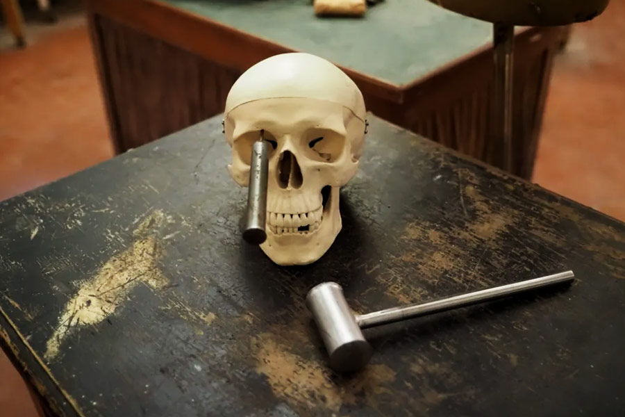 Lobotomy surgery was performed to treat mental illness.