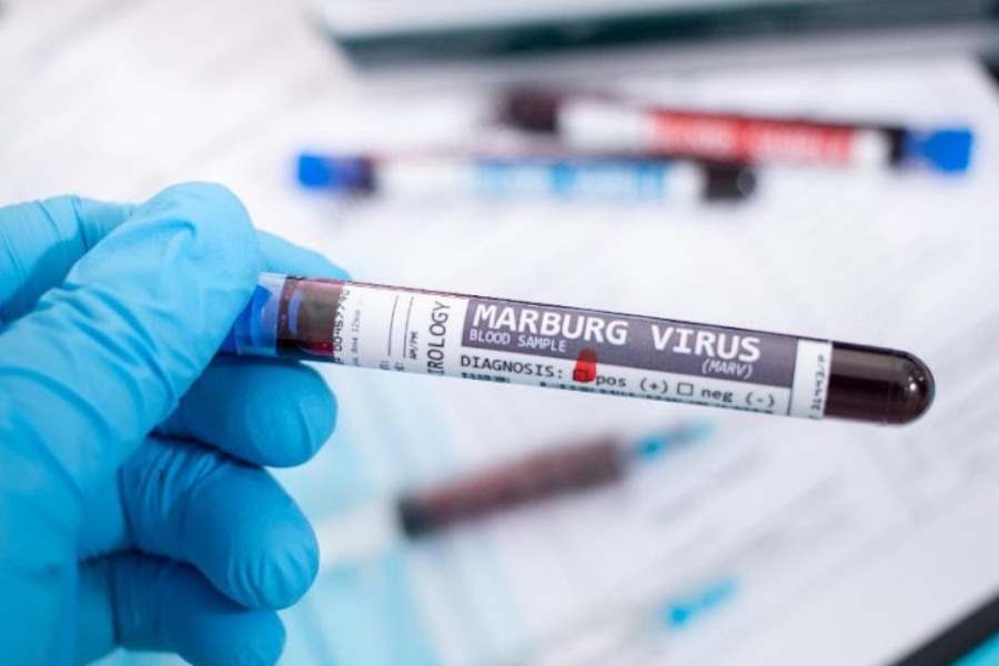 symbolic image of Marburg virus.