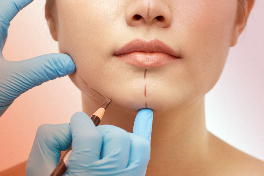 representational image of plastic surgery 