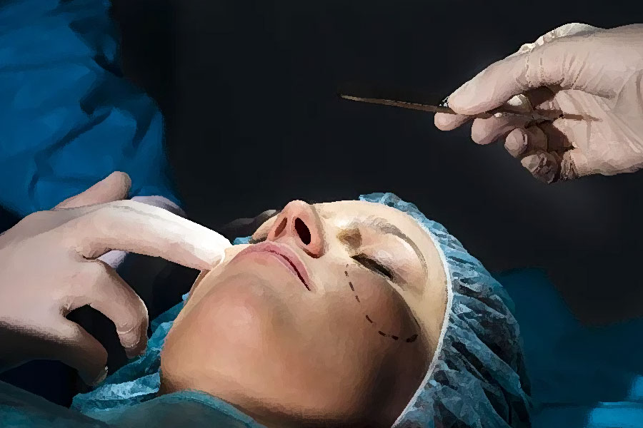representational image of plastic surgery 