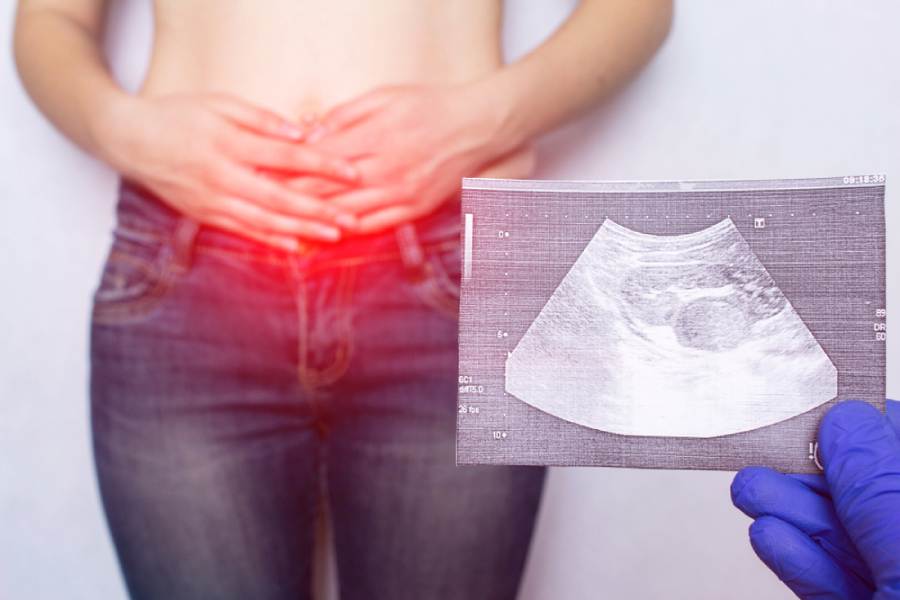 symbolic image of Hernia symptoms.