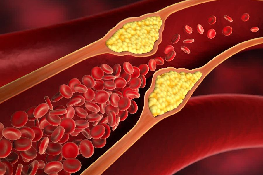 Symbolic image of blood artery 