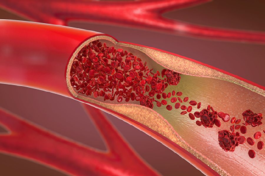 Symbolic Image of blood vessel