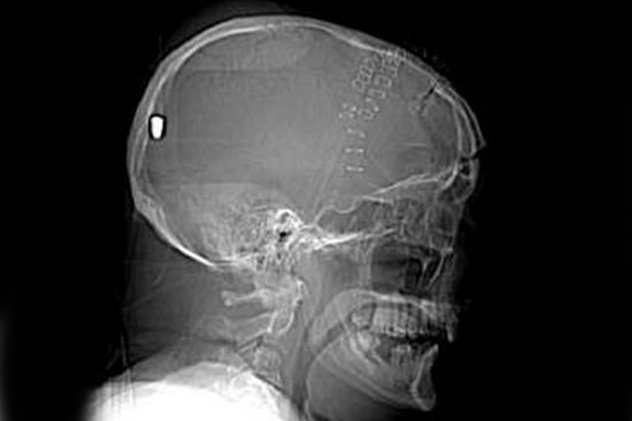 ওই তরুণ আমেরিকার ফ্লোরিডার সেন্ট লুইসি কাউন্টির বাসিন্দা। নাম মাইকেল ময়লান। বয়স ৪৫ বছর। স্ত্রী এপ্রিলের সঙ্গে এক বাড়িতে থাকতেন। সুখী দাম্পত্য ছিল তাঁদের।