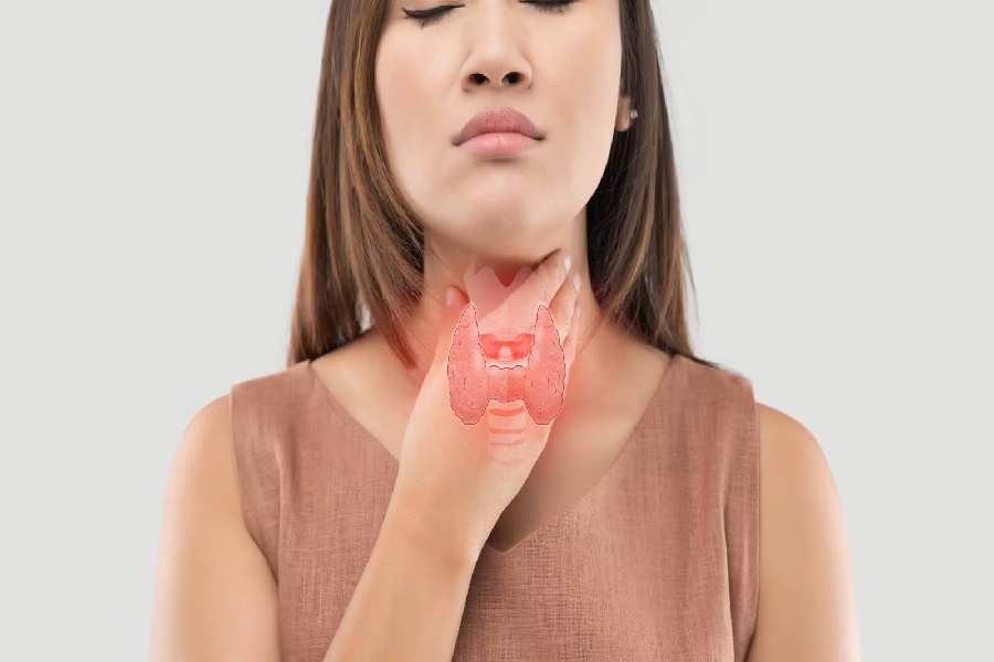 Image of Thyroid Problem. 