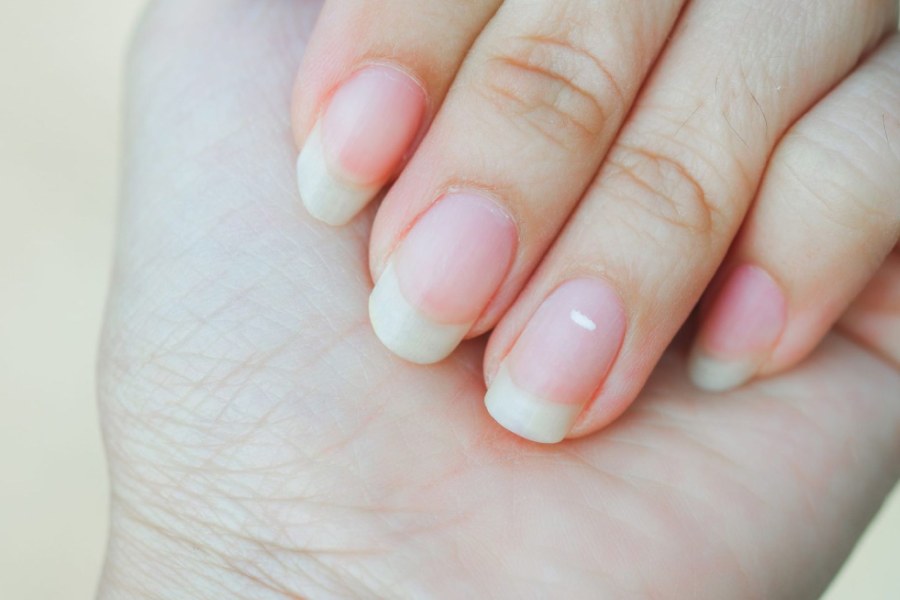 image of the white spot of nail