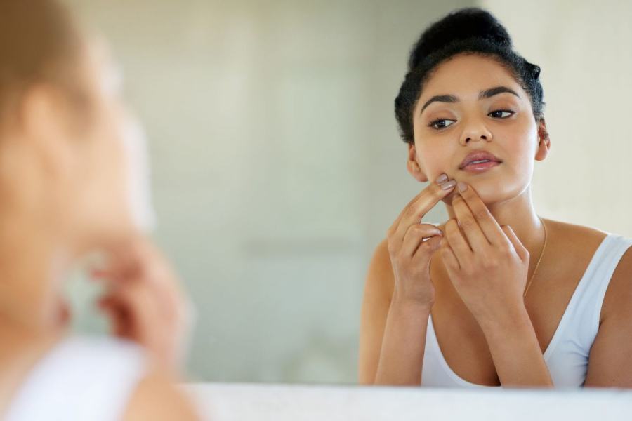 পিসিওএস-এ মুখে ভর্তি ছোট ছোট ব্রণ দেখা দেয়।