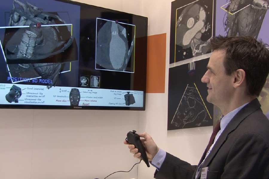 ঠিক কী দেখা গিয়েছিল সেই গবেষণায়? এমআরআই স্ক্যানারের মধ্যে দম্পতির যৌনমিলনের সময় দেখা যায়, মিলনের সময় পুরুষাঙ্গ বুমেরাং-এর মতো বেঁকে যায়। অর্থাৎ ঋজু পুরুষাঙ্গও অনমনীয় নয়। বরং মিলনকালে নারীদেহে প্রবেশের পর তা বিশেষ ভাবে বেঁকে যায় কোনও রকম যন্ত্রণা ছাড়াই।