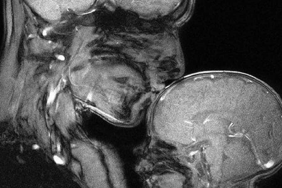 কিন্তু স্ক্যান করার পরই শেষ হয়নি কাজ। প্রথিতযশা কোনও বিজ্ঞানপত্রিকায় এই ধরনের গবেষণা প্রকাশ করা কঠিন হয়ে দাঁড়ায়। পাশাপাশি, কেবল একটি মাত্র সঙ্গমের ছবির উপর ভিত্তি করে বৈজ্ঞানিক দাবি করা নিয়েও প্রশ্ন তোলেন অনেক বিশেষজ্ঞ। গবেষকের দাবি, বিজ্ঞানপত্রিকা নেচার কোনও কারণ না দেখিয়েই তাঁদের গবেষণাপত্র প্রকাশ করতে অস্বীকার করে।