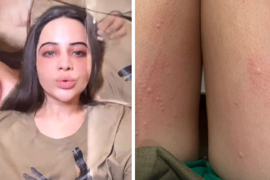 গা-ভর্তি অ্যালার্জি উরফির