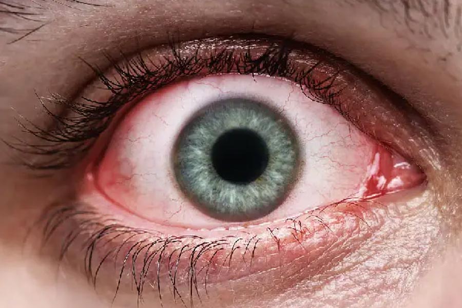 রানির নির্দেশে প্রথমে ওই ব্যক্তির চোখ উপড়ে নেওয়া হয়। তার পর তাঁর চিকিৎসা করিয়ে সুস্থ করে তোলা হয়। সুস্থ করে তোলার পর তাঁর শরীরের চামড়া পুরোপুরি তুলে ফেলা হয়। কিন্তু রানির নির্দেশ অনুযায়ী তিন বার শাস্তি দিতে হবে। তাই তৃতীয় বার তাঁকে শাস্তি দিতে ক্রুশবিদ্ধ করে মারা হয়।