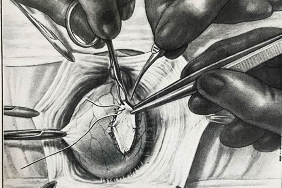 লন্ডনের সভায় উপস্থিত বিশ্বের তাবড় চিকিৎসক এবং বিশেষজ্ঞকে ভোরোনফ তাঁর প্রতিস্থাপনের নমুনার ছবি দেখিয়ে চমকে দিয়েছিলেন। তিনি দেখিয়েছিলেন, কী ভাবে অস্ত্রোপচারের পর বয়স্কদের চেহারা এবং অন্যান্য আনুসাঙ্গিক বিষয়ে চোখে পড়ার মতো বদল এসেছে।