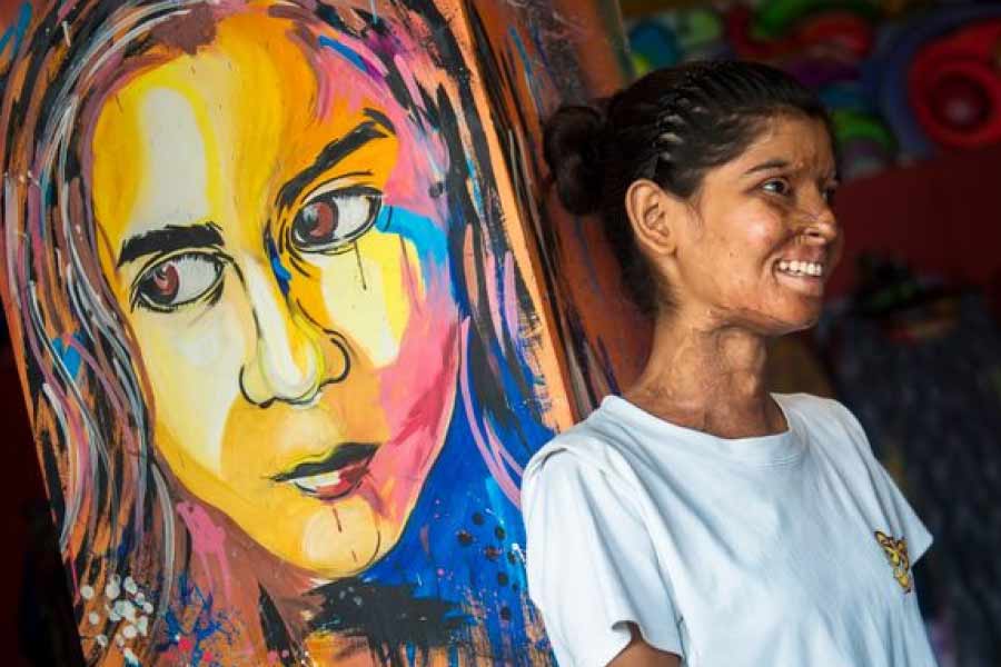 “এক দিন দিদির শ্বশুরবাড়ির উঠোনে বসেছিলাম। হঠাৎ মুখের উপর গরম চায়ের মতো কিছু এসে পড়ল। প্রথমে ঝুঝে উঠতে পারিনি। কয়েক সেকেন্ডের মধ্যেই মুখের চামড়া গলে গলে পড়তে লাগল। জ্ঞান হারিয়েছিলাম ওই দৃশ্য দেখে,’’— বলছেন রুকেয়া। তাঁর কথায়, ‘‘মৃত্যুর সঙ্গে লড়াই করছিলাম। এক মাস চিকিৎসায় একাধিক অস্ত্রোপচারের পর বাড়ি ফিরি। পুলিশের কাছে অভিযোগ জানানোর কথা ভেবেছিলাম। কিন্তু দিদির শ্বশুরবাড়ি থেকে সাফ জানিয়ে দেওয়া হয়েছিল, পুলিশে অভিযোগ জানালে দিদিকে ‘হামেশা’র জন্য বাড়ি থেকে তাড়িয়ে দেওয়া হবে। দিদির কথা ভেবেই আর অভিযোগ জানাইনি।”