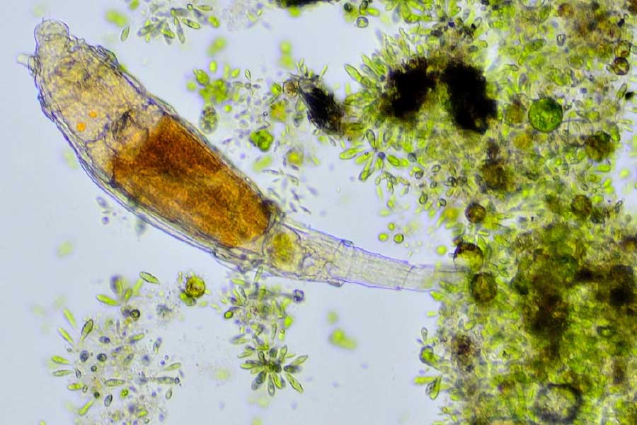 ডেলয়েড রটিফারের দেহের আকার যতটা ক্ষুদ্র, সেই তুলনায় তার দৈহিক বৈশিষ্ট্য অনেক বেশি জটিল। 