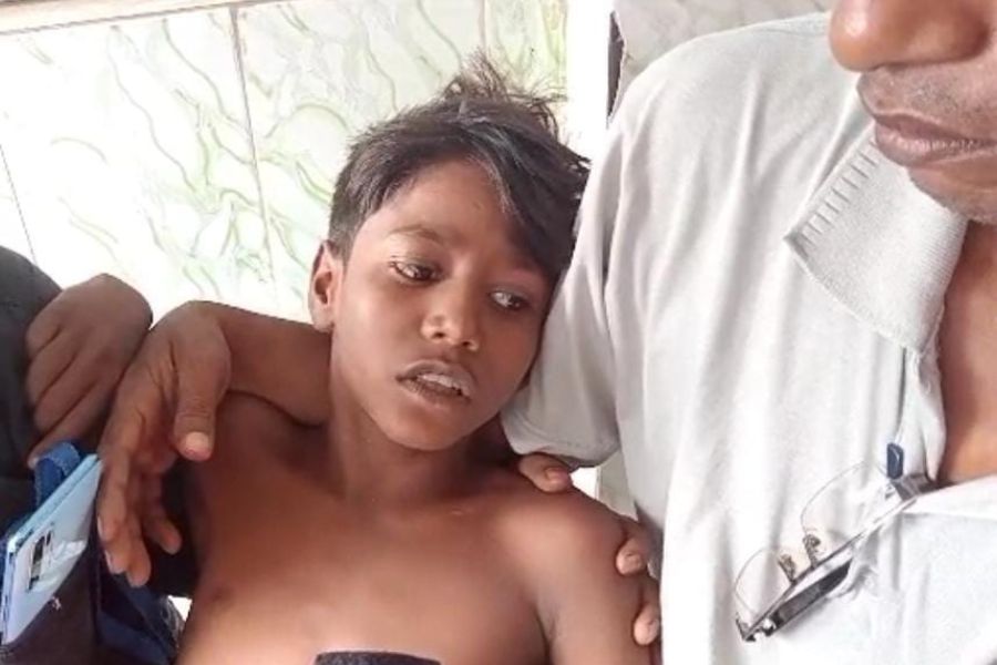 Boy injured after blast