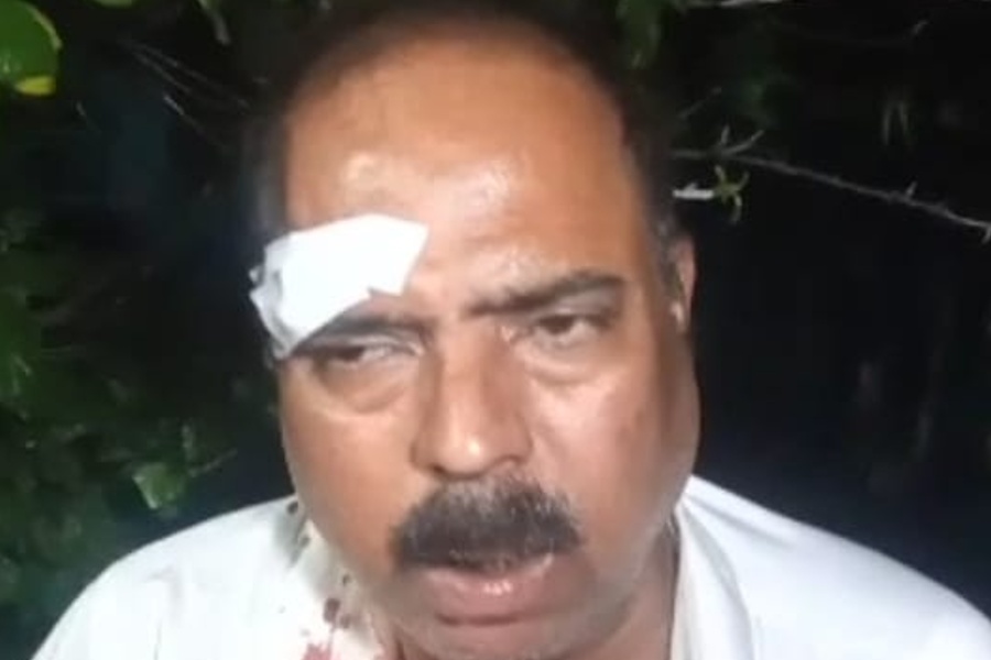 Ex-Chairman of Howrah attacked by goon