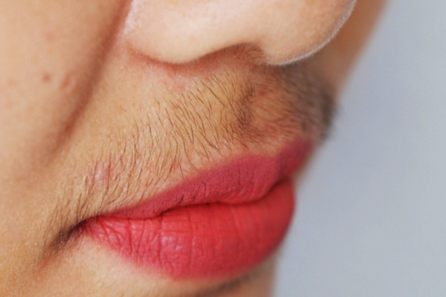 Image of facial hair