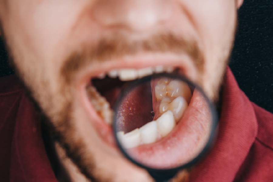 চোয়ালে ব্যথা কিংবা ফুলে গেলেও সতর্ক থাকুন।