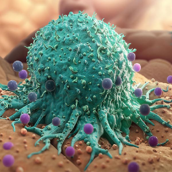 representative image of cancer cell