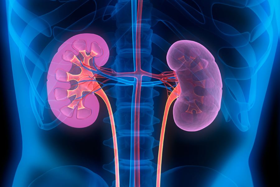 image of kidney problem.