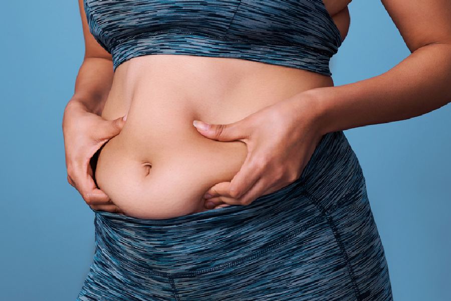Image of belly fat 