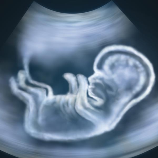 চিকিৎসকেরা সঞ্জুর পেটে ছুরি দিয়ে চিরতেই তার ভিতর থেকে চলকে বেরিয়ে আসে প্রচুর পরিমাণে জৈবরস। তার পরে বেরিয়ে আসে একটি সম্পূর্ণ মানবদেহ!