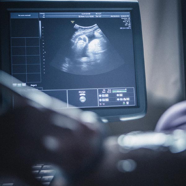 পরে চিকিৎসকেরা বুঝতে পারেন এটি আসলে একটি বিরল ঘটনা। যেখানে মায়ের গর্ভে একটি ভ্রূণের ভিতরে আরও একটি ভ্রূণ জন্ম নেয়।