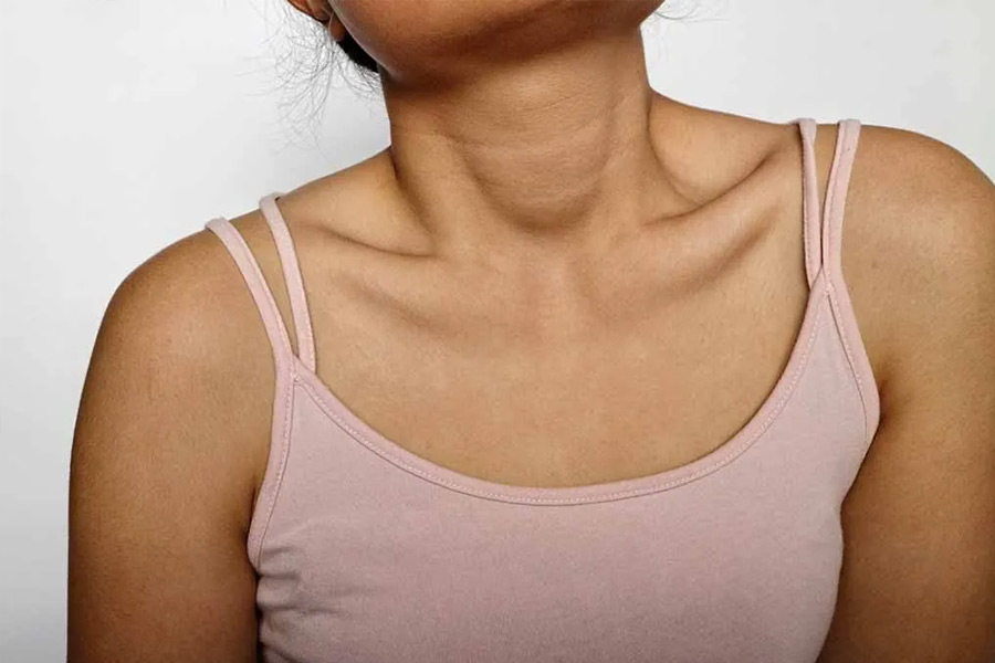 Image of neck.
