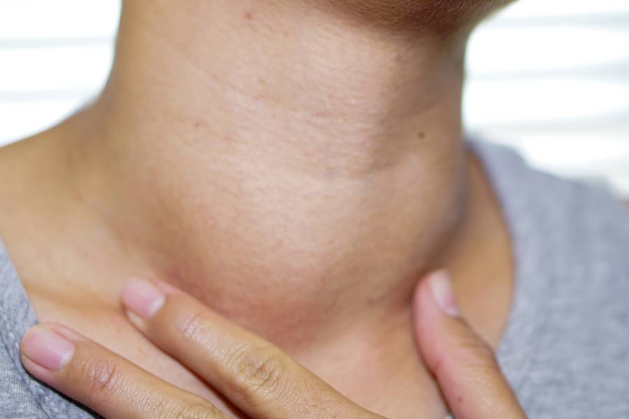 Image of thyroid.