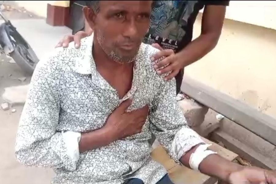Injured Congress worker in Raninagar of Murshidabad