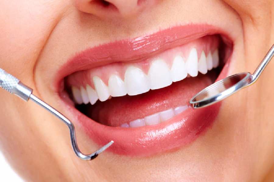Symbolic Image of Cosmetic Dental Treatment.
