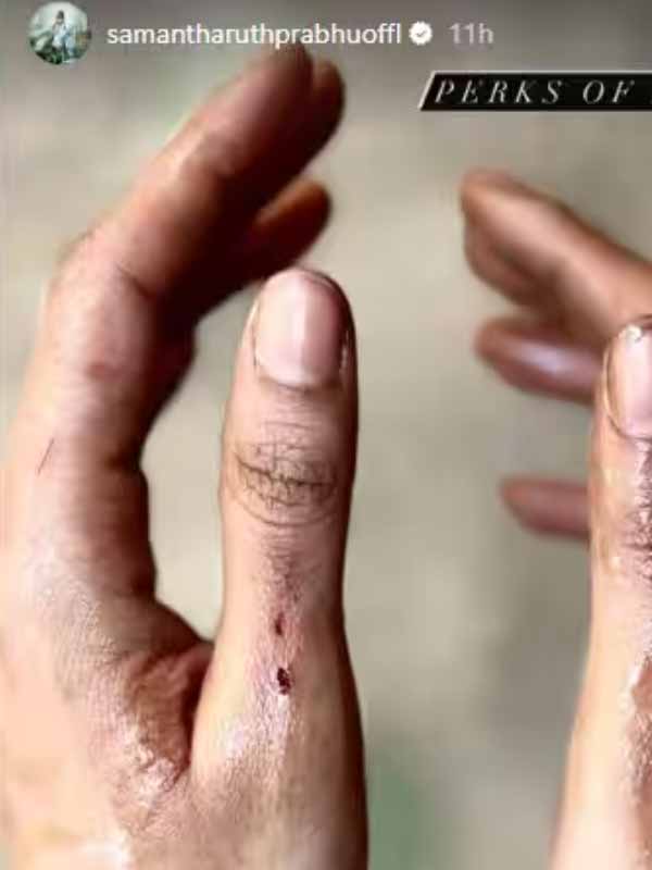 Pictures Of Samantha's hand