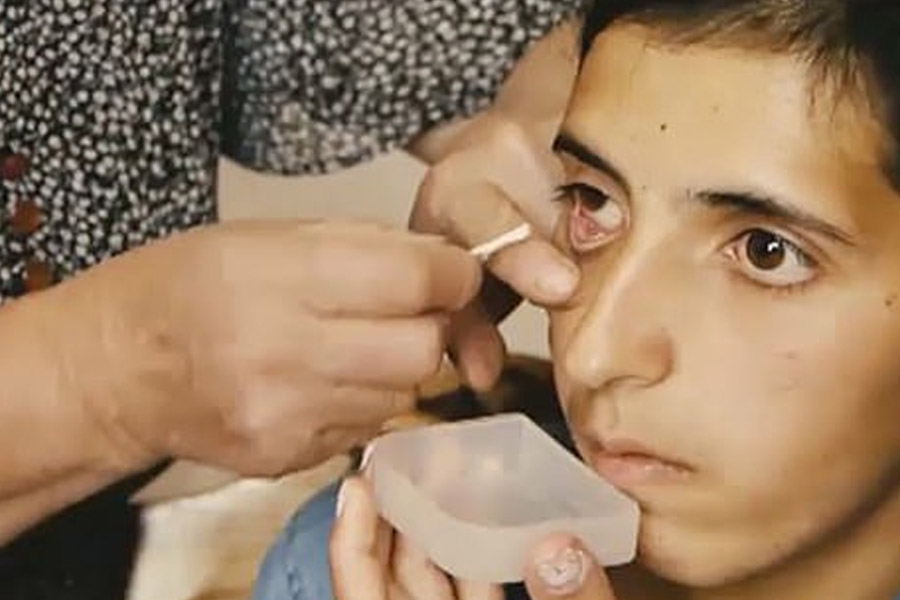 Armenian girl who alleges of crying crystals is suffering from rare disease.