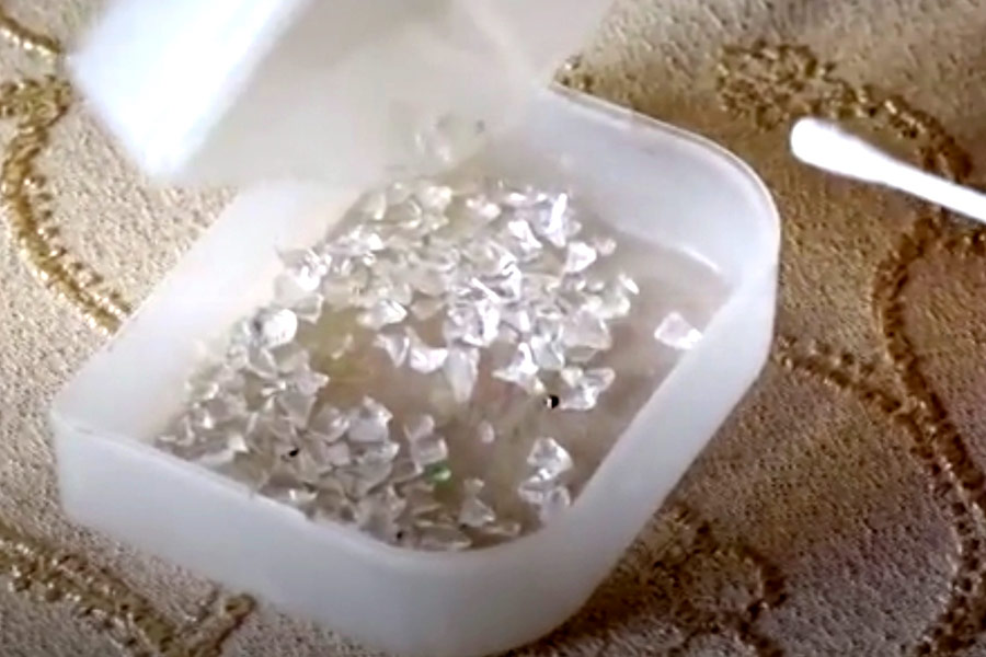 Armenian girl who alleges of crying crystals is suffering from rare disease.