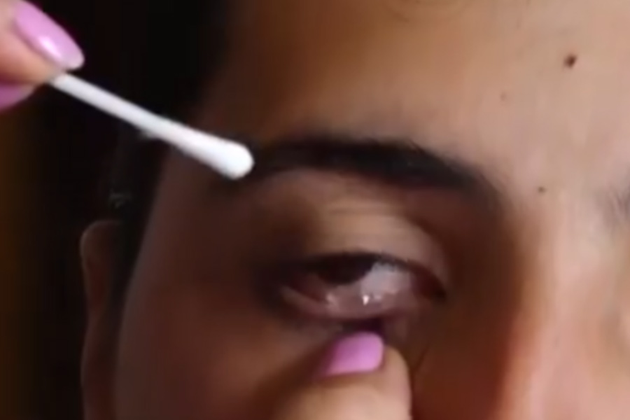 Armenian girl who alleges of crying crystals is suffering from rare disease.