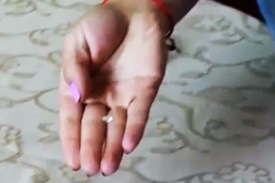 Armenian girl who alleges of crying crystals is suffering from rare disease.