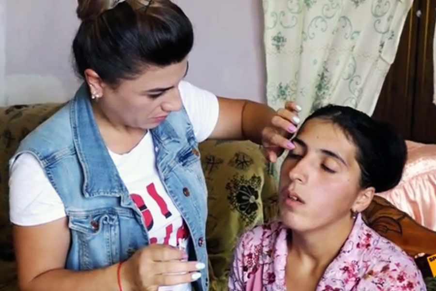 Armenian girl who alleges of crying crystals is suffering from rare disease.
