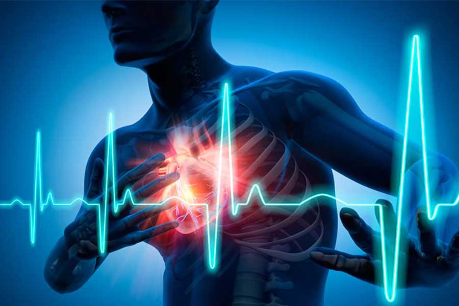 a representative photograph of Heart Attack