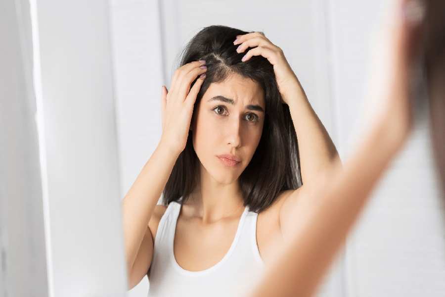 Symbolic Image of Hair Fall.