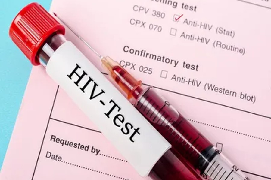 An image of HIV Test