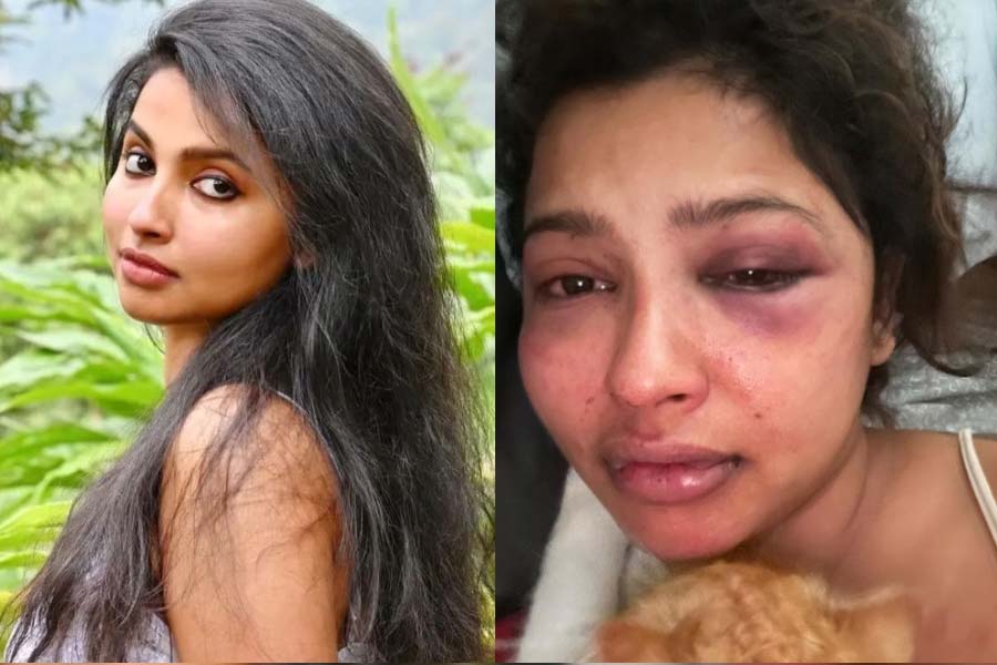 Picture Of Actress Anicka Vikhraman