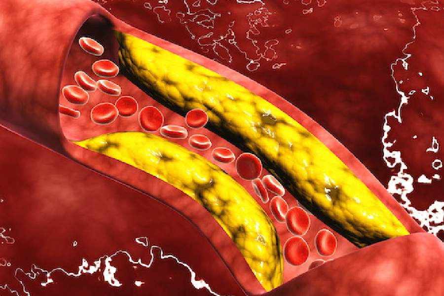 Symbolic image of cholesterol 