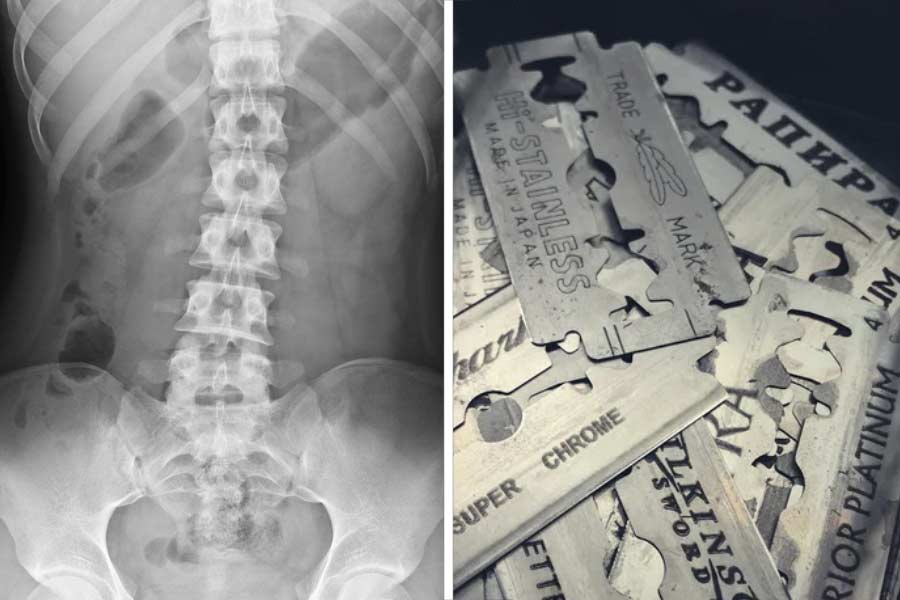 Image of X-rays