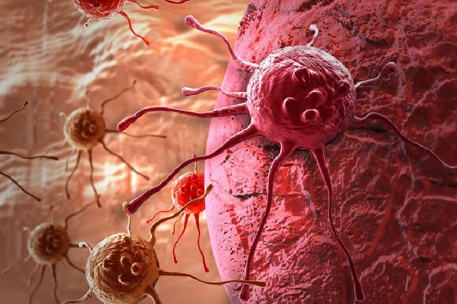 AI develops cancer treatment in just 30 days, predicts patients’ life expectancy based on medical notes dgtl