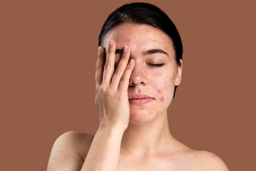 image of skin care problem