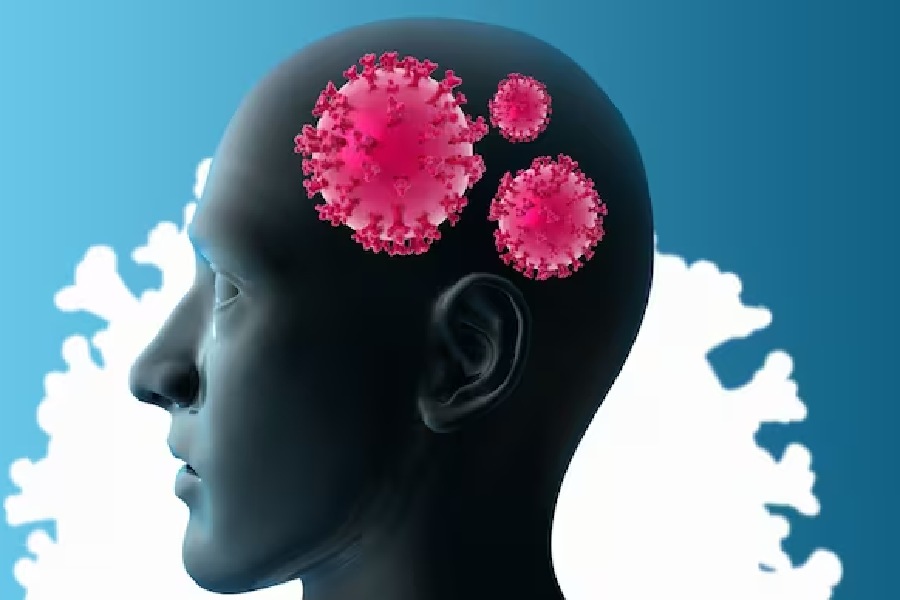 Symbolic Image of Brain